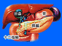 解剖　胆管切開切石　胆嚢摘出　手術　高槻　胆石　胆管結石