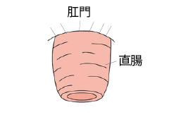 直腸脱について | 社会医療法人 東和会グループ 第一東和会病院
