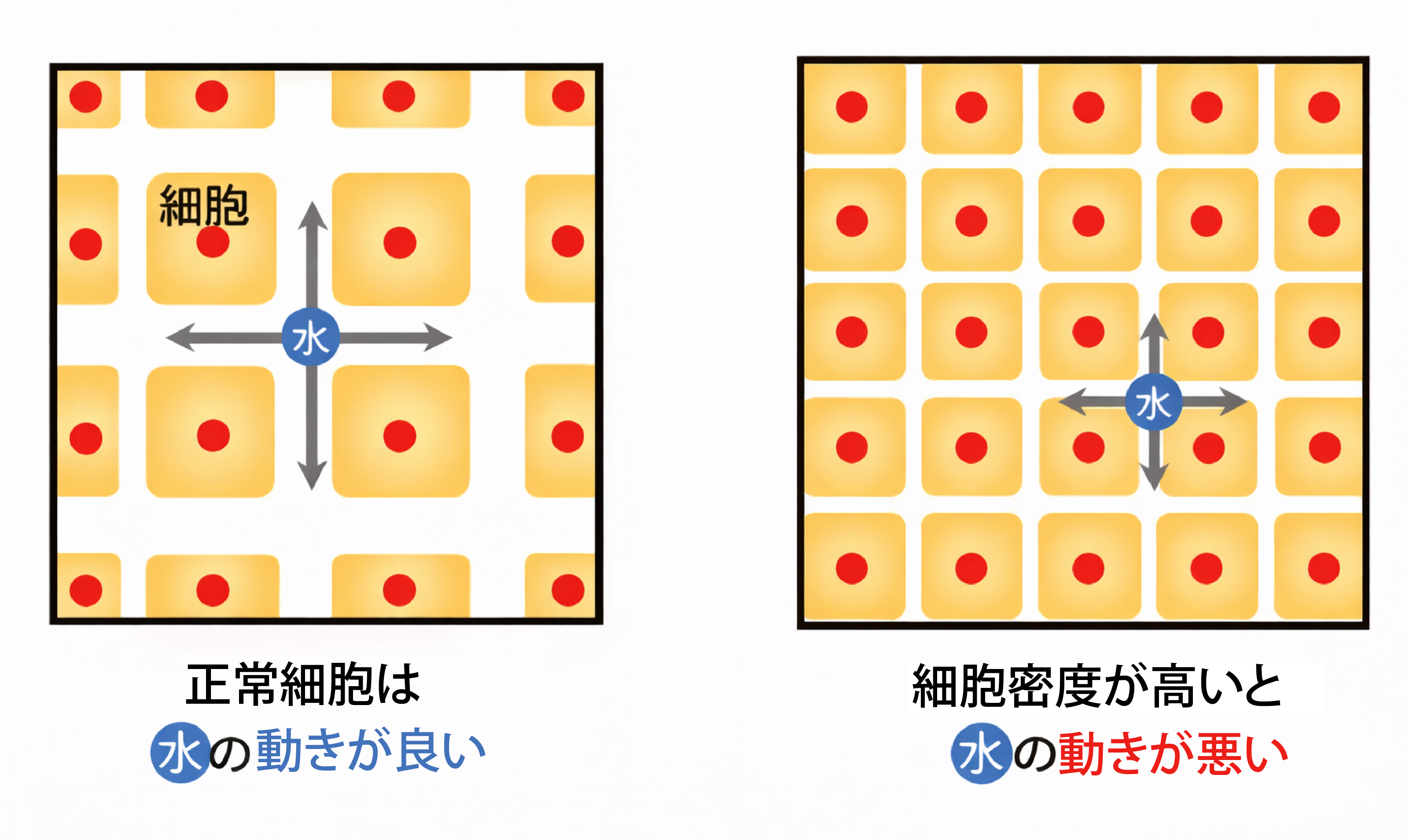 DWIBS検査の原理 - 正常組織とがん細胞の違い