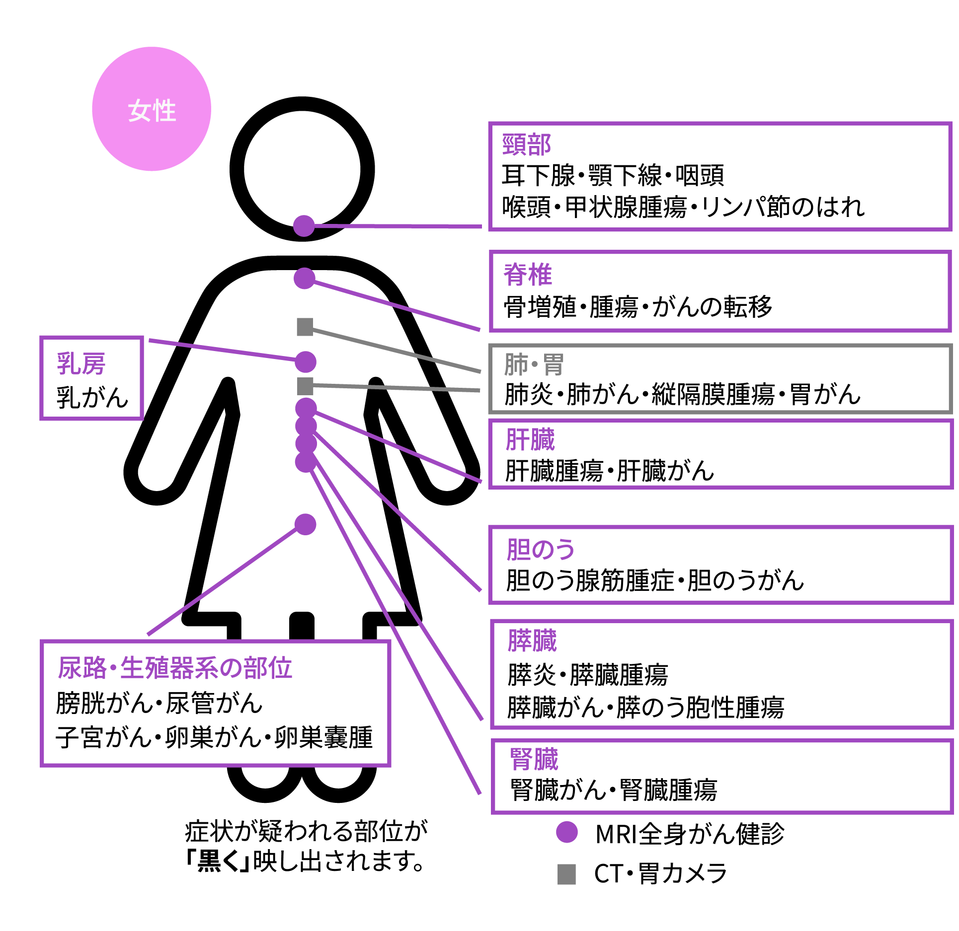 DWIBS検査の対象部位（女性）